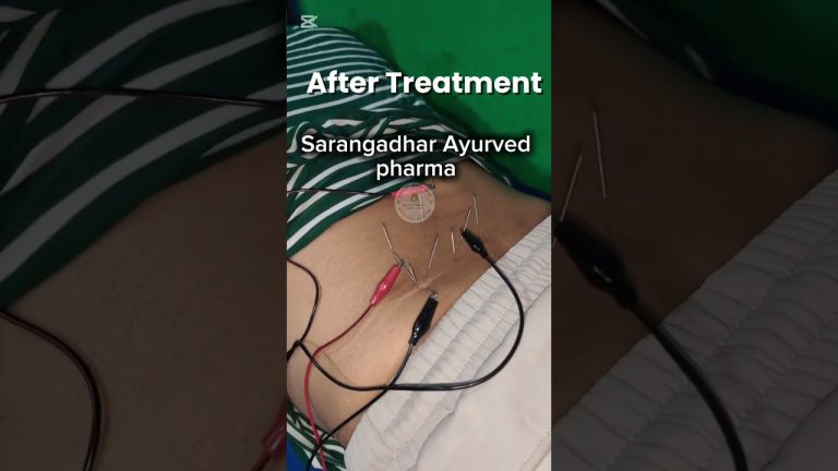 साथीलाई impress गर्न खोज्दा.injury ले stressदियो”