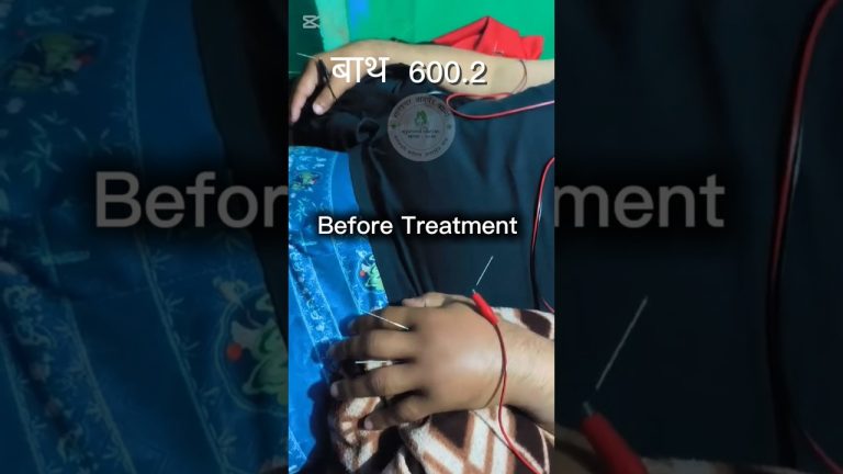 600 बाट314बाथको समस्या अब नियन्त्रणमाBefore vs After फरक आफैं हे